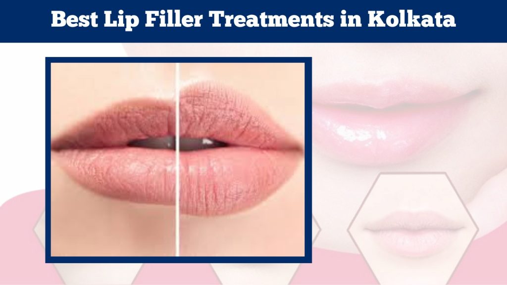Best Lip Filler Treatments in Kolkata