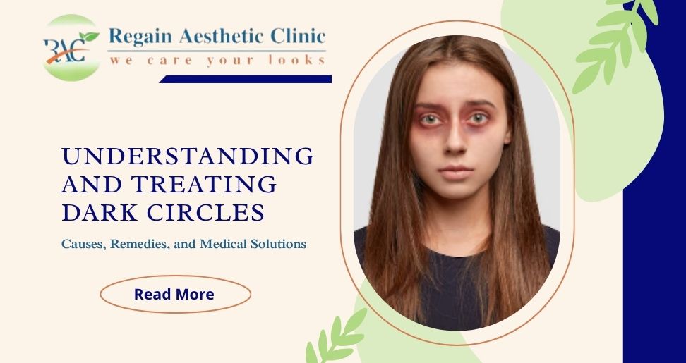 Understanding and Treating Dark Circles: Causes, Remedies, and Medical Solutions | Regain Aesthetic Clinic