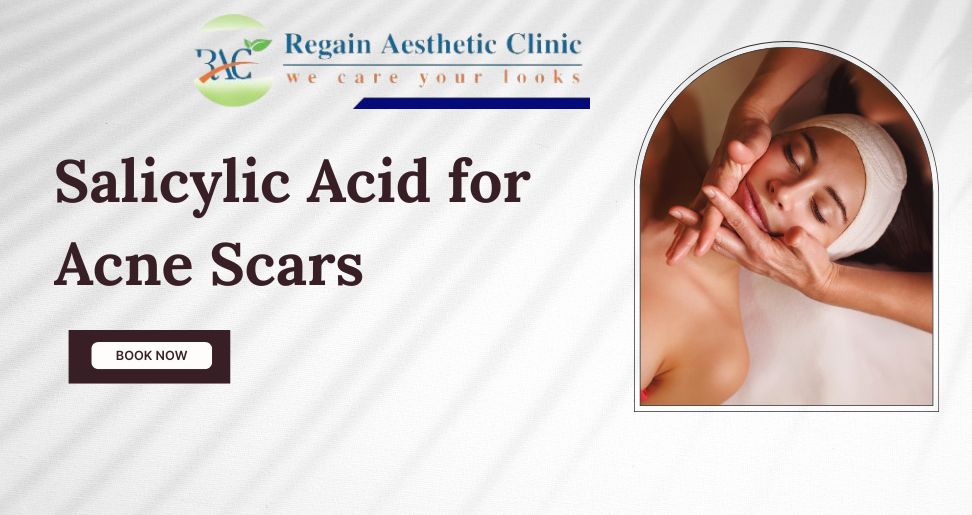 Salicylic Acid for Acne Scars Benefits, Uses, and Side Effects (Complete Guide)