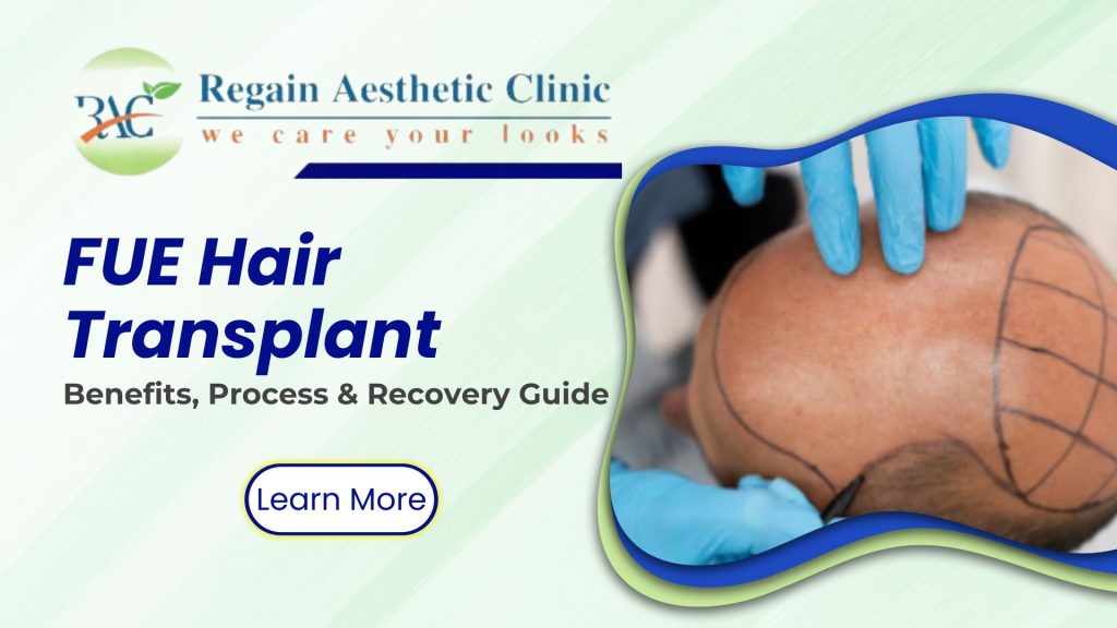 FUE Hair Transplant: Benefits, Process & Recovery